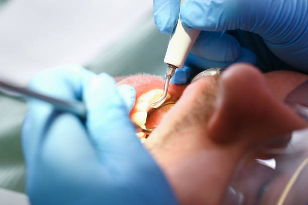 Best Walk-In Emergency Dentist in Deland, FL