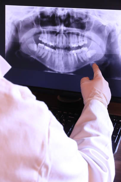 Best Emergency Wisdom Teeth Removal in Deland, FL